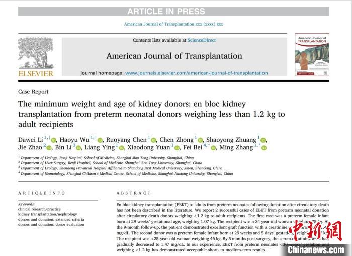 上海专家挑战肾移植供体低龄、低体重极限造福更多尿毒症患者